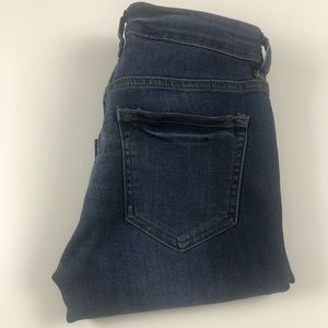 Zipper Leg || Skinny Jeans | Blue Jean